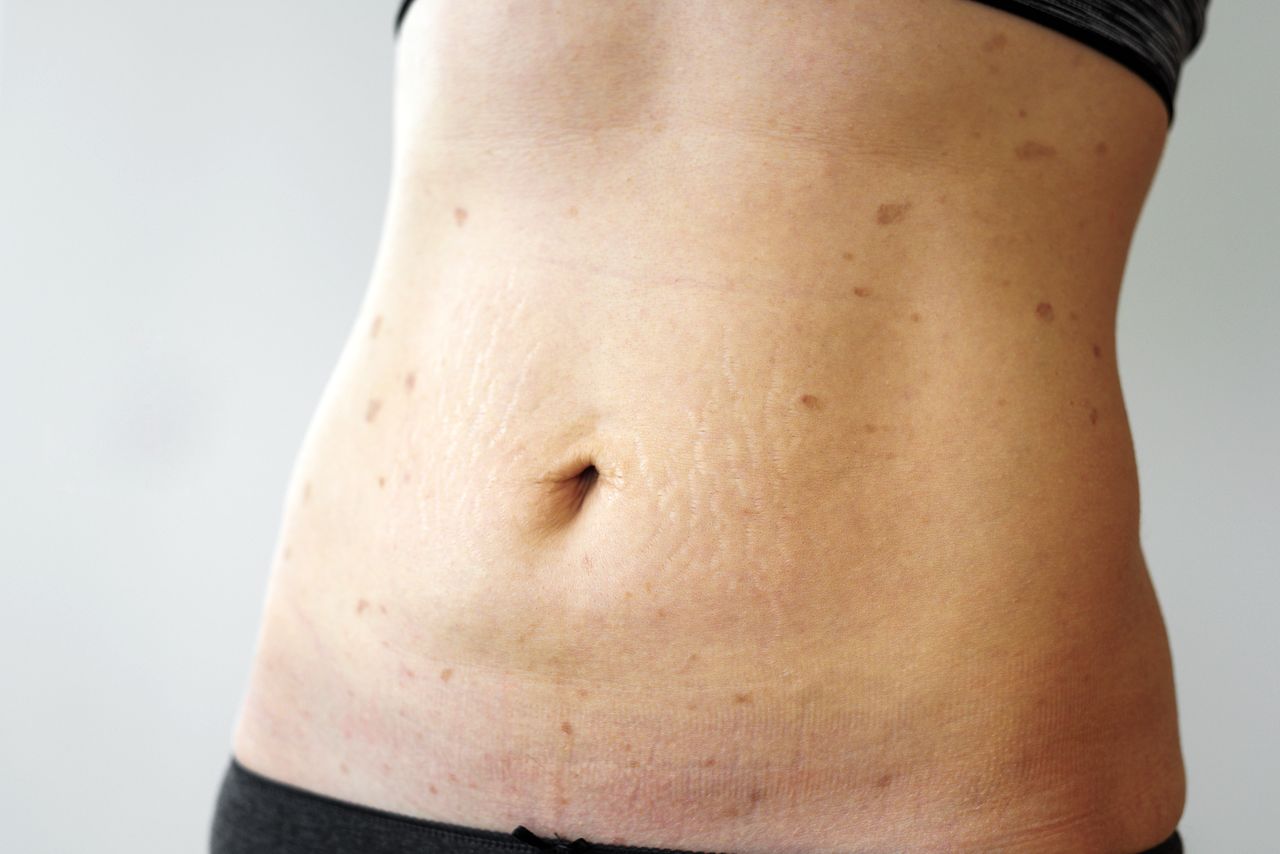 Plaque rouge sur le corps sans démangeaison Dresswing